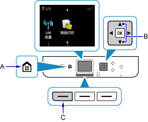 “主页”屏幕:选择“LAN设置”